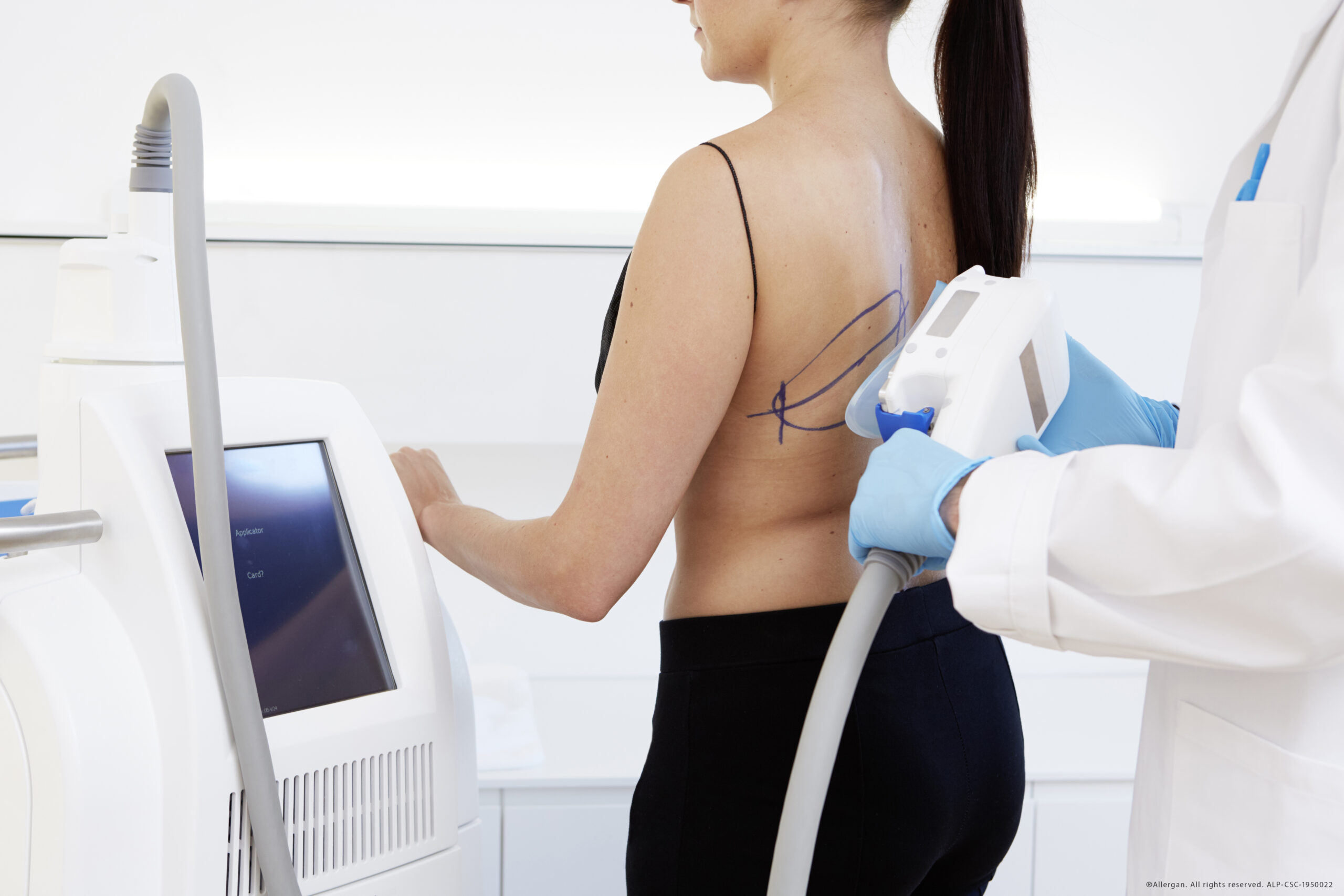 ALLERGAN_160719_11_Behandlung_Brustfett_Ruecken_37611_Copyright