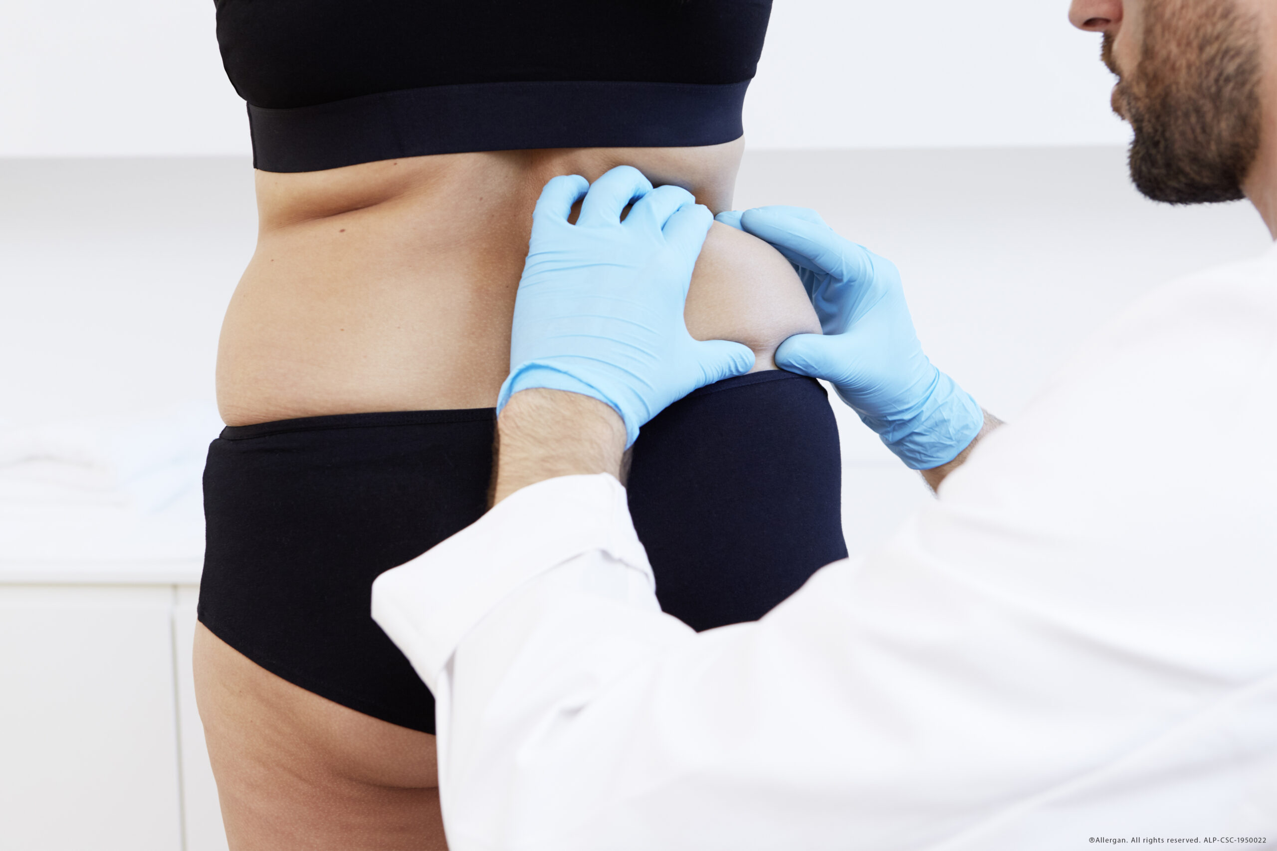 ALLERGAN_160719_12_Beratung_Flanke_Frau_37649_Copyright